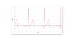 figure.gdx-ekg._ekg-trace.001.png