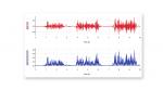 figure.gdx-ekg._emg._forearm.001.png